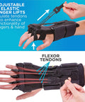 Radial Nerve Palsy Splint For Wrist Drop Relief, Dynamic Wrist Extension Brace with adjustable finger lifts, right hand view