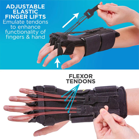 Radial Nerve Palsy Splint For Wrist Drop Relief, Dynamic Wrist Extension Brace with adjustable finger lifts, right hand view