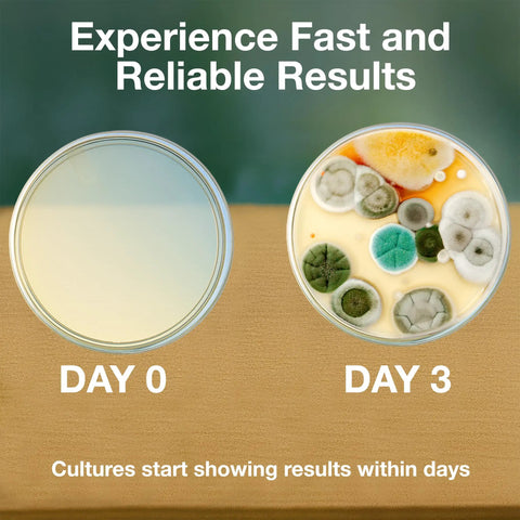 Hands On Microbiology Science Kit For Students With Ten Pre Poured Agar Plates And Cotton Tipped Sticks Learn Microbiology At Home Or In Class With Easy To Follow Instructions An Educational Experiment Guide And Ebook - showing petri dishes with mold growth comparison over three days.