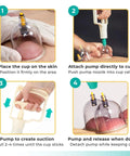 Steps for using Five Pack Manual Suction Pump For Cupping Therapy Sets, showing pump attachment and suction on skin with clear cupping jars.