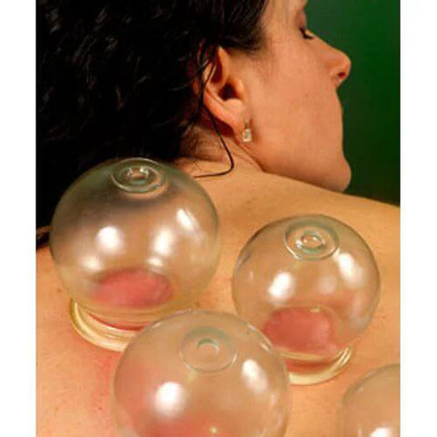 Woman receiving therapy with Pro Grade Glass Fire Cupping Jars Set With Four Sizes, Extra Thick Medical Grade Glass With Finger Grips.